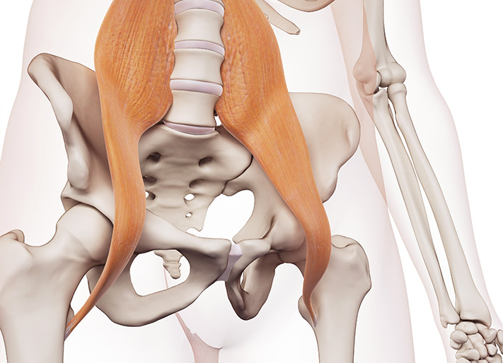 Tendinite du psoas - Chirurgie Orthopedique Valence